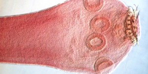 Parasitic tapeworm